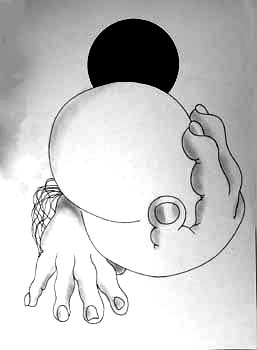 Monomania