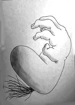 heartburn