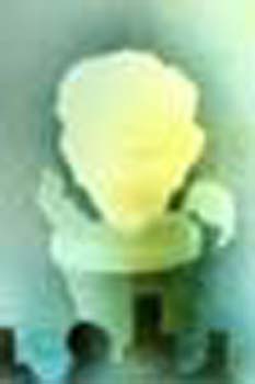 118