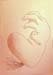 heartburn